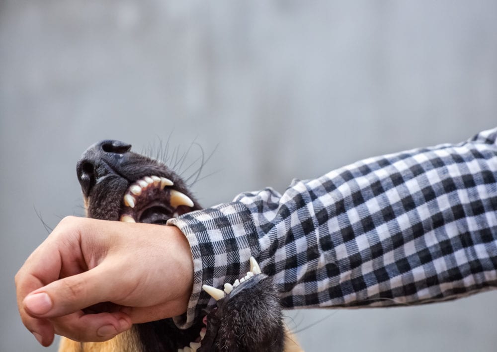 A male German shepherd bites a man by the hand. BEATTIE LAW FIRM, P.C.